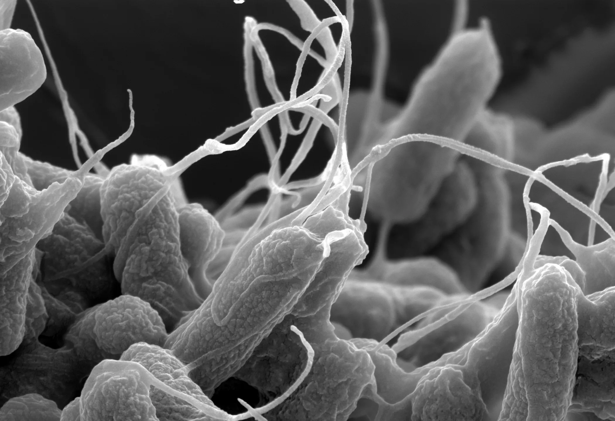 Microscopic Images: "E. coli bacteria at ×25,000 magnification" by Nurgul D