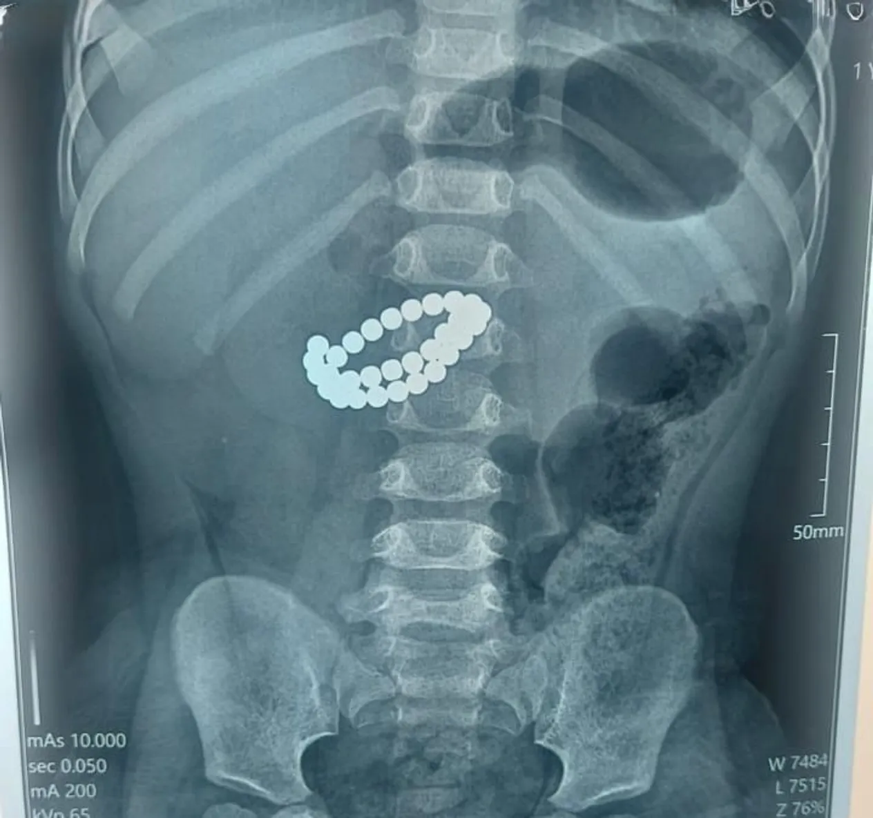 Фото: пресс-служба акимата Алматы